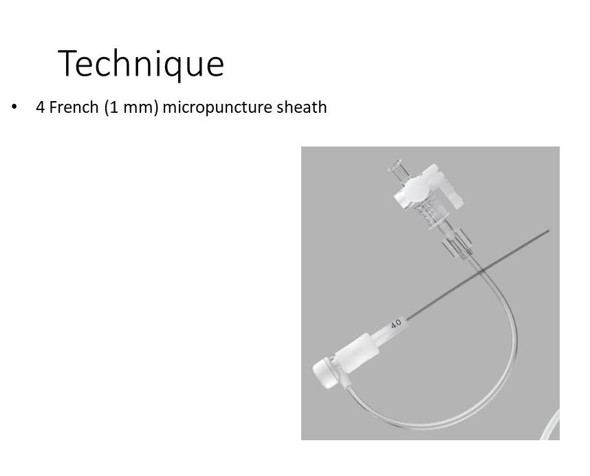 Catheter Genicular Knee Arteries